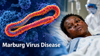 Marburg Virus Disease